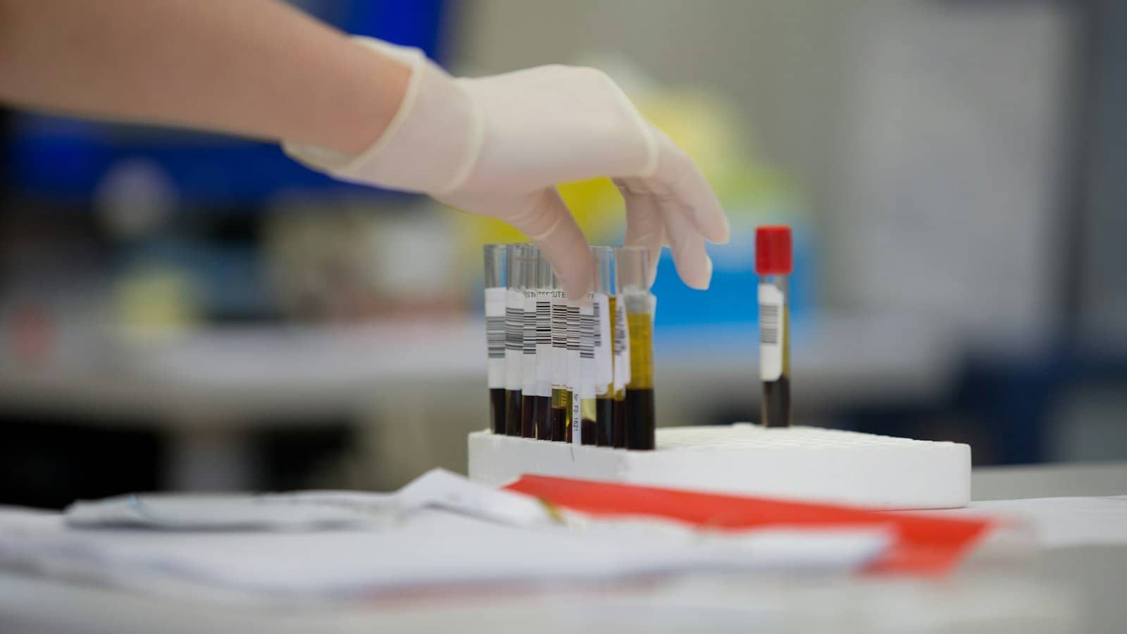 PEP: o que fazer após exposição ao HIV em até 72 horas