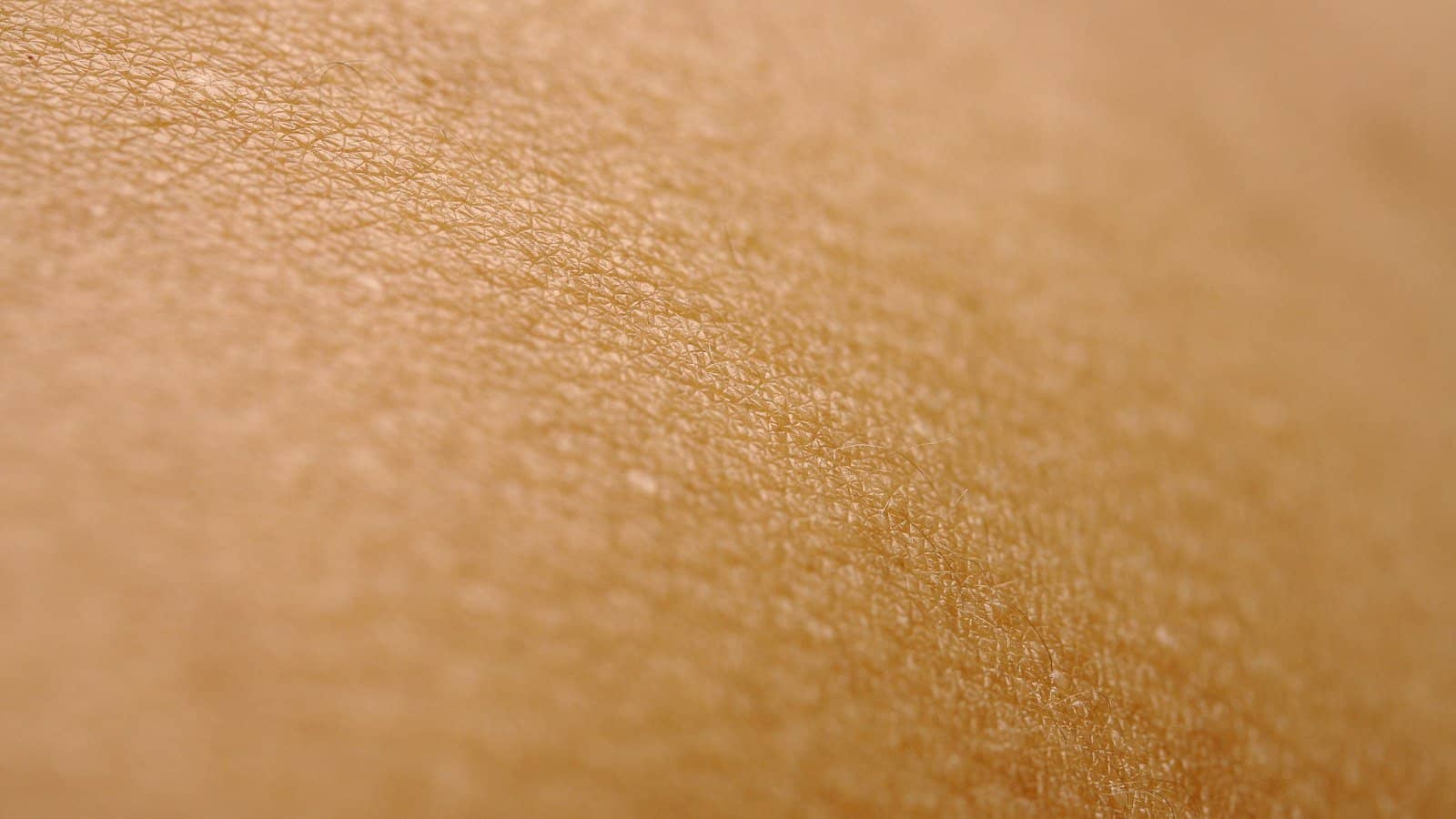Isotretinoína para acne: como funciona e cuidados